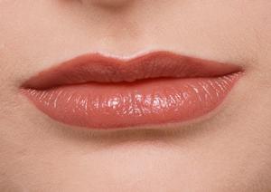 「アザの悩みを解消！効果的なレーザー治療の全貌と選び方ガイド」